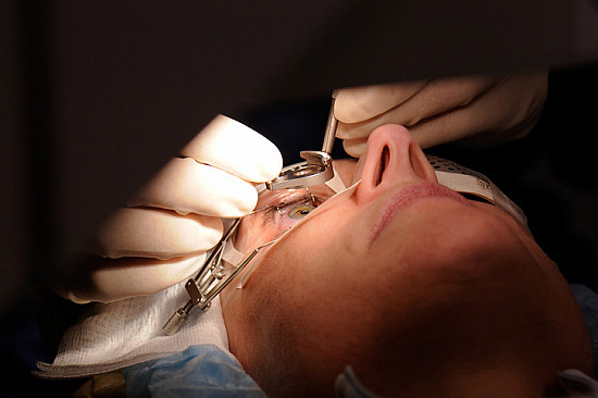 How is LASIK performed?